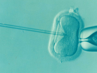 Trotz Kryptozoospermie die Chance auf eigenen Nachwuchs verbessern