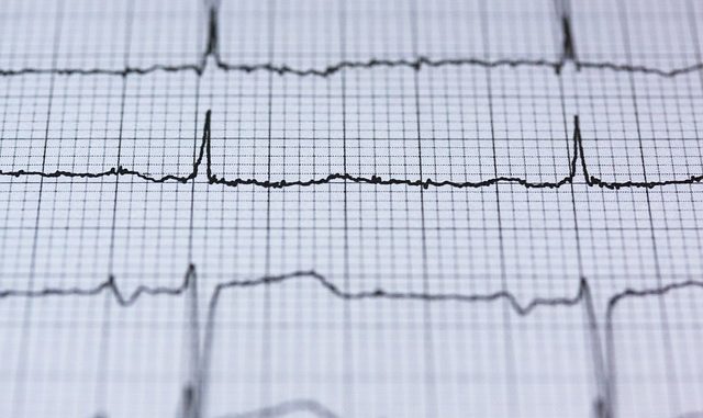Herzrhythmusstoerungen in der Schwangerschaft Herzrhythmusstoerungen in der Schwangerschaft – was nun?