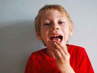 Milchzahn abgebrochen – Was ist genau zu tun?