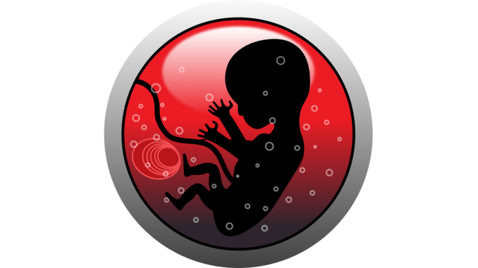 Retroplazentares Haematom Retroplazentares Haematom