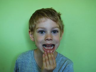 Zahnwechsel beim Kind