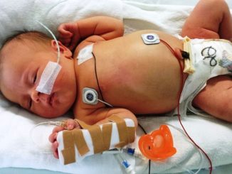 Atemaussetzer beim Baby